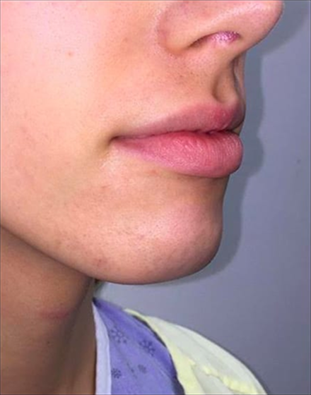 before-06