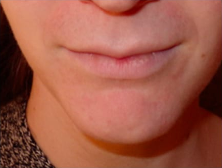 before-after-01 2